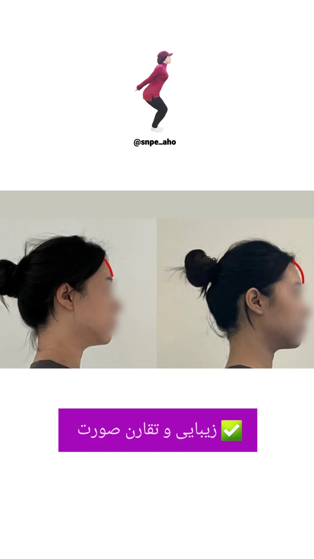 آموزش جامع و کامل ورزش اصلاحی کره ای SNPE توسط مربی برتر آهو
