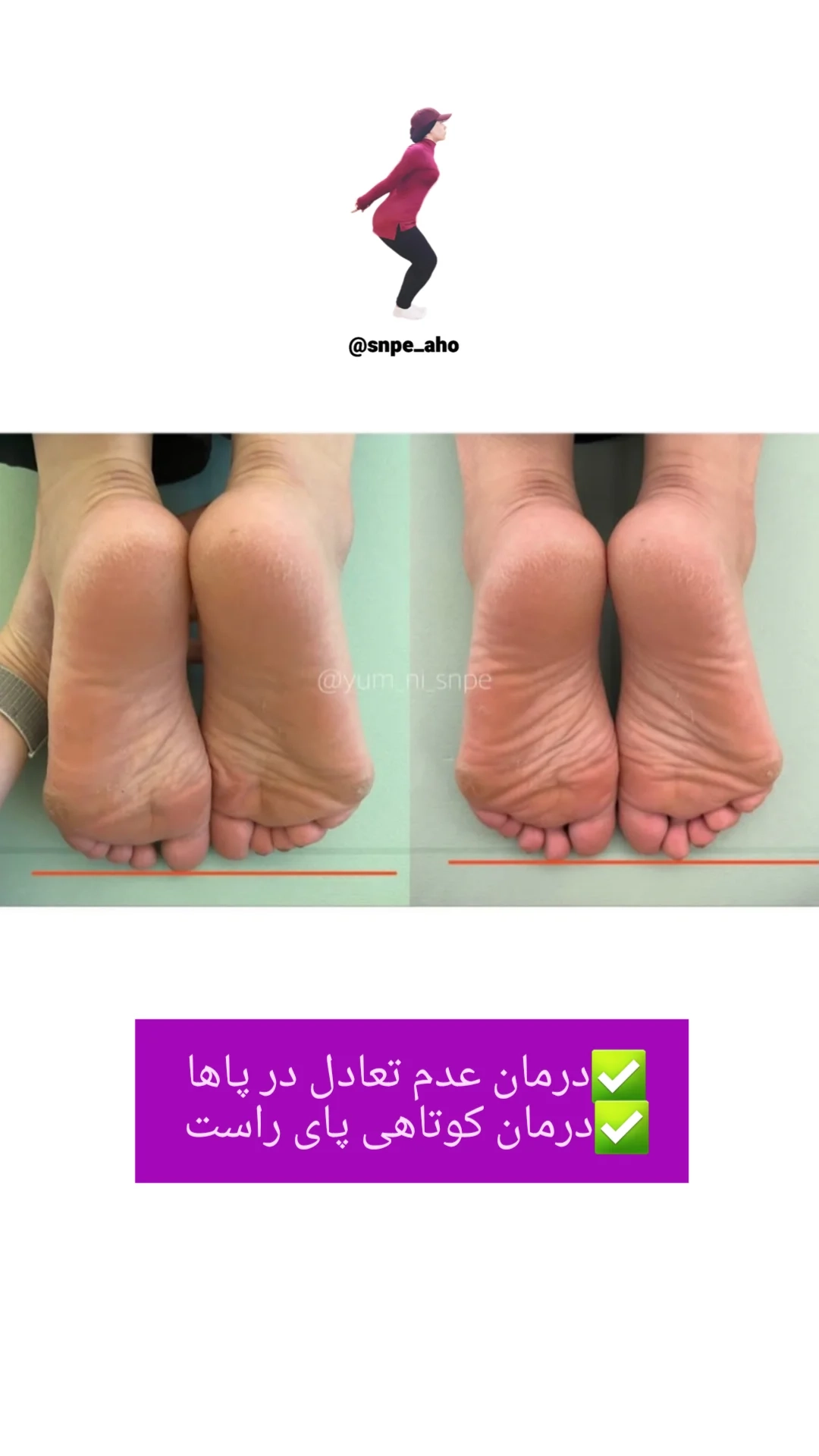 آموزش جامع و کامل ورزش اصلاحی کره ای SNPE توسط مربی برتر آهو
