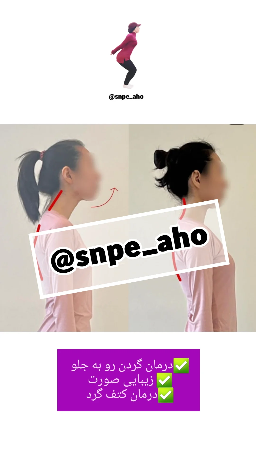 آموزش جامع و کامل ورزش اصلاحی کره ای SNPE توسط مربی برتر آهو